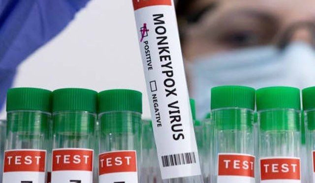 سعودی عرب میں بھی خطرناک وائرس ’منکی پاکس‘ کے کیسز کی تصدیق