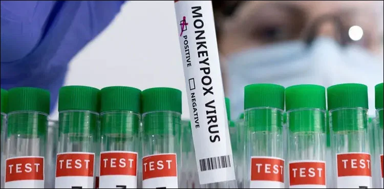 کراچی میں منکی پاکس کا ایک اور کیس سامنے آ گیا